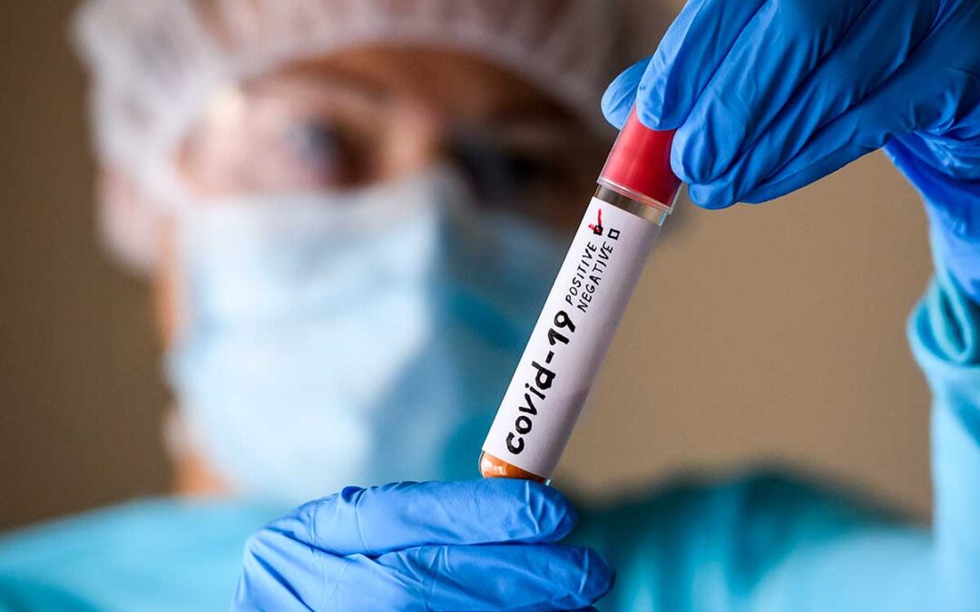 Esami per COVID-19 (test sierologici, tamponi rapidi antigenici e tamponi molecolari)