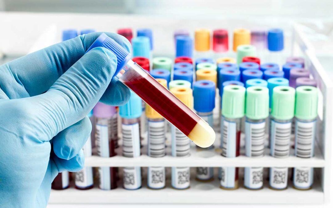 Pannello ampio di test genetici: prenatali, pre-concepimento, infertilità ecc…