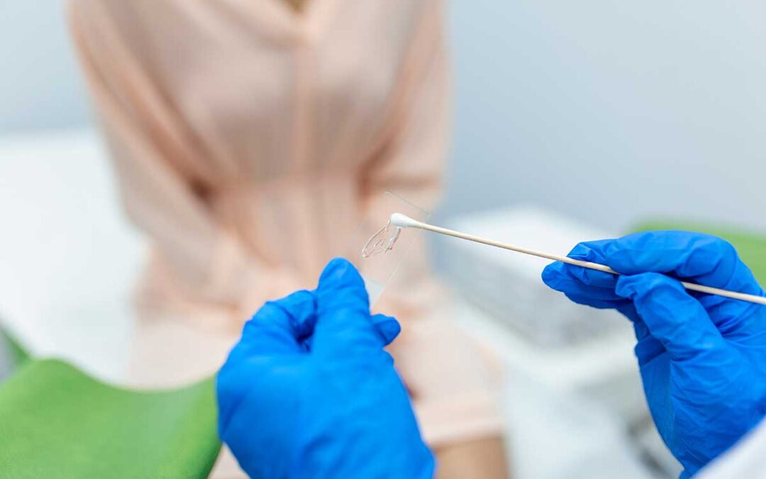 PAP-test in fase liquida e per la ricerca del Papilloma virus